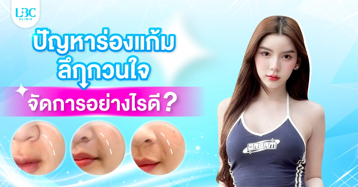 ปัญหาร่องแก้มลึกกวนใจ จัดการอย่างไรดี?