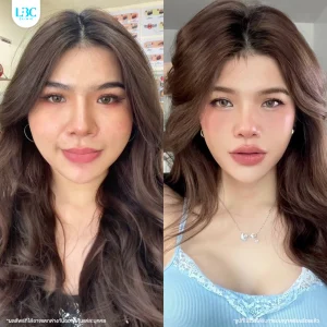 LBC แอลบีซี BT
