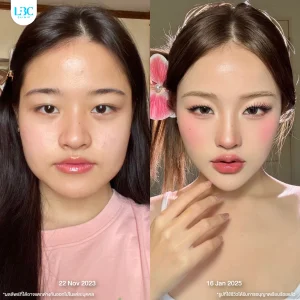 LBC แอลบีซี BT