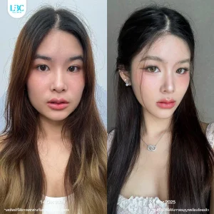 LBC แอลบีซี BT