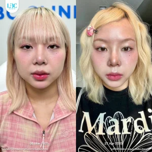 LBC แอลบีซี BT