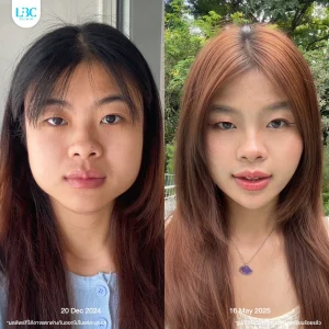 LBC แอลบีซี BT