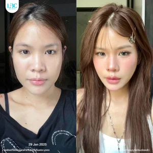 LBC แอลบีซี BT