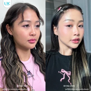 LBC แอลบีซี BT