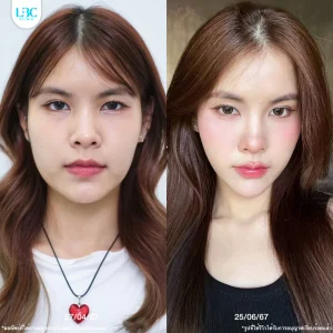LBC แอลบีซี BT