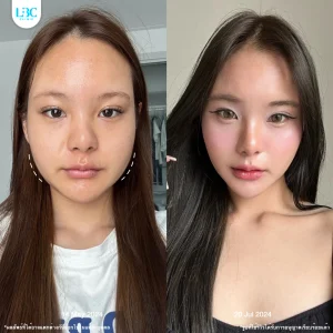 LBC แอลบีซี BT