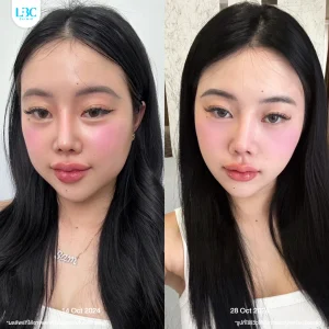 LBC แอลบีซี BT