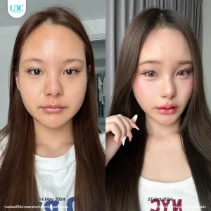 LBC แอลบีซี BT