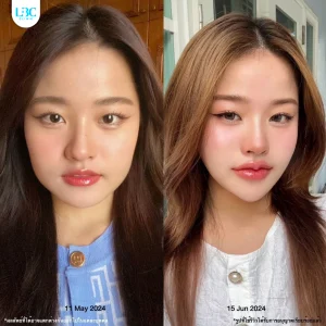 LBC แอลบีซี ยกกระชับ รีวิวจริง