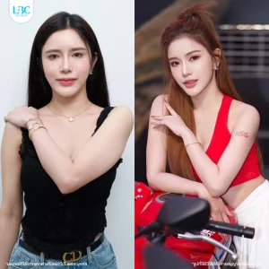 LBC แอลบีซี รีวิวจริง