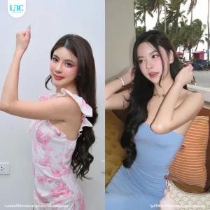 LBC แอลบีซี รีวิวจริง