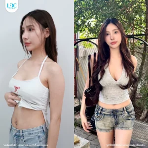 LBC แอลบีซี รีวิวจริง