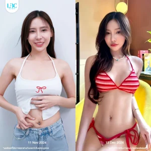 LBC แอลบีซี รีวิวจริง