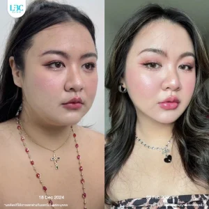 LBC แอลบีซี รีวิวจริง