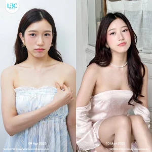 LBC แอลบีซี รีวิวจริง