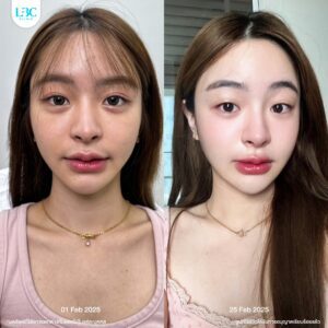 LBC แอลบีซี - ดูแลผิวหน้าใส