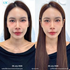 LINE_ALBUM_หมอหลุย_260921_2