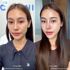 LINE_ALBUM_หมอหลุย_260921_8