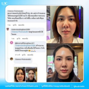 tp รีวิวหมอหลุยส์-01