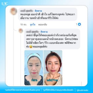 tp รีวิวหมอหลุยส์-02