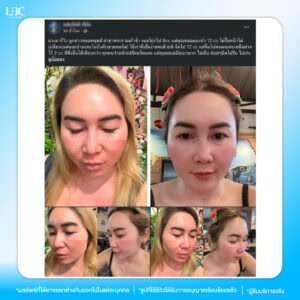 tp รีวิวหมอหลุยส์-04