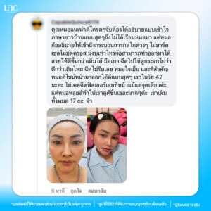 tp รีวิวหมอหลุยส์-06
