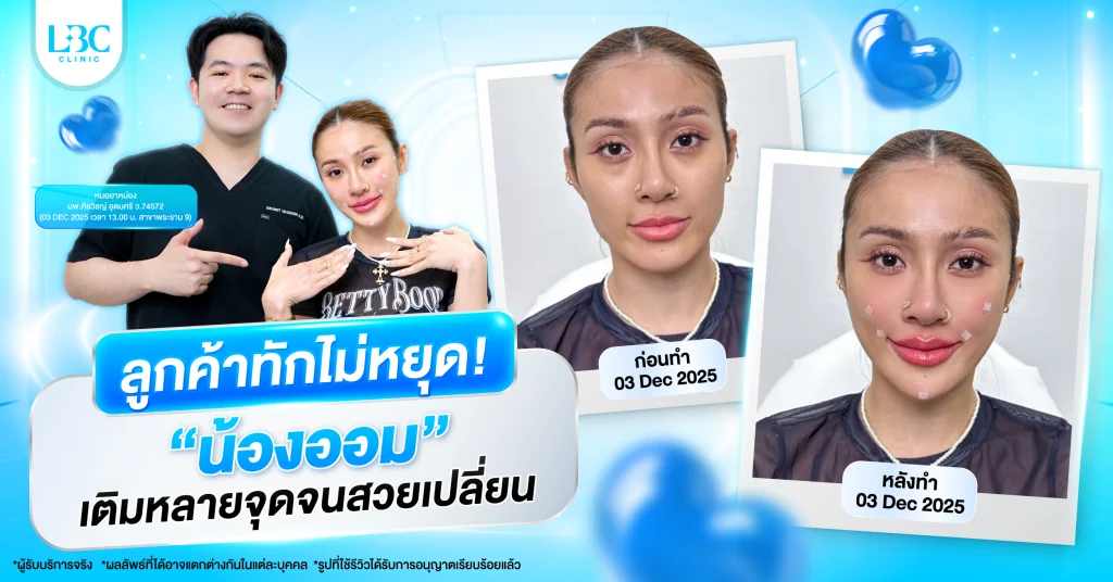 รีวิวโปรแกรมฟิลเลอร์ทั่วหน้า