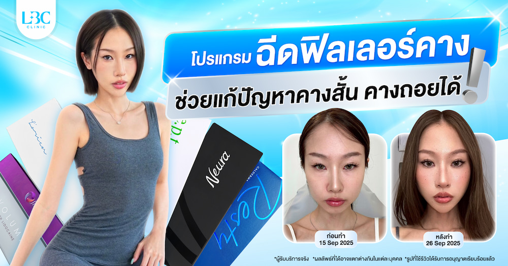 โปรแกรมฉีดฟิลเลอร์คาง ช่วยแก้ปัญหาคางสั้น คางถอยได้